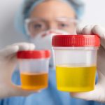 Helpful Information for Comparing Popular Screening Preparation Product Options