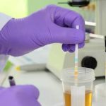 How Modern Validation Screening Tests Dehydrate and Spot Simulated Human Urine Samples