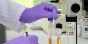 How Modern Validation Screening Tests Dehydrate and Spot Simulated Human Urine Samples
