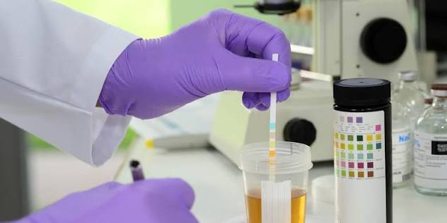 How Modern Validation Screening Tests Dehydrate and Spot Simulated Human Urine Samples